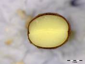 Embryo Chart Image