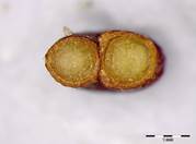 Embryo Chart Image