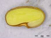 Embryo Chart Image