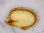 Embryo Chart Image