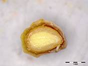 Embryo Chart Image