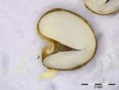 Embryo Chart Image