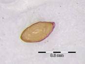 Embryo Chart Image