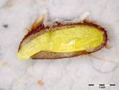 Embryo Chart Image